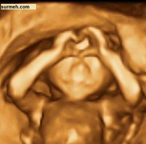 جنجال عاشقانه های جنین در سونوگرافی شکم مادر